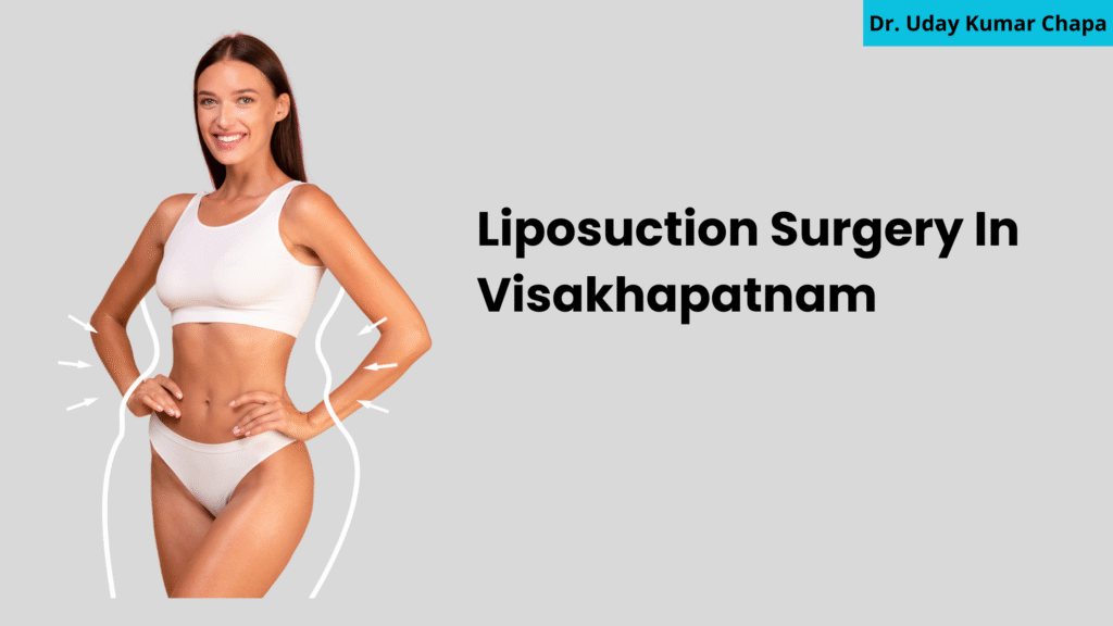 Liposuction Surgery In Visakhapatnam