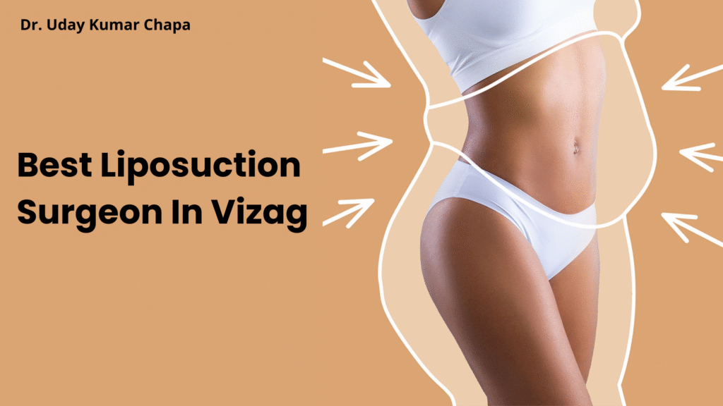 Best Liposuction Surgeon In Vizag