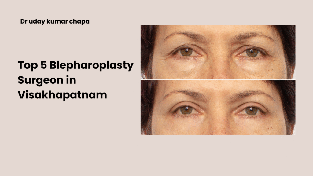 top 5 blepharoplasty surgeon in visakhapatnam