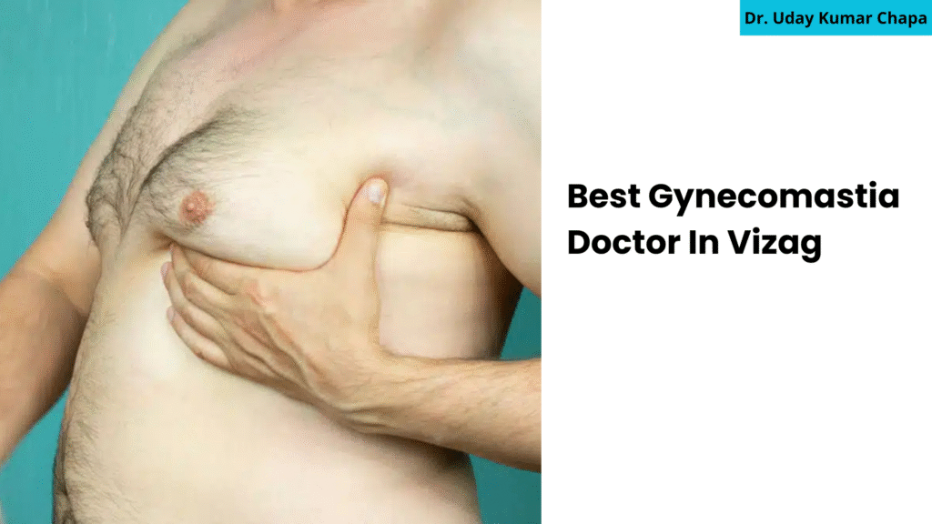 Best Gynecomastia Doctor In Vizag