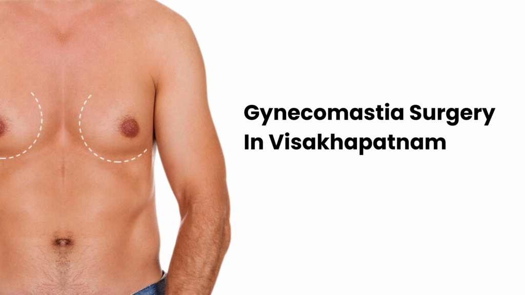 Best Gynecomastia Surgery in Visakhapatnam – Dr. Uday Kumar Chapa