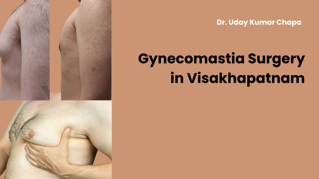 Gynecomastia Surgery in Visakhapatnam