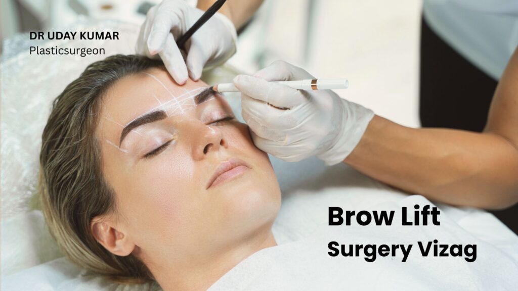BROW LIFT SURGERY VIZAG