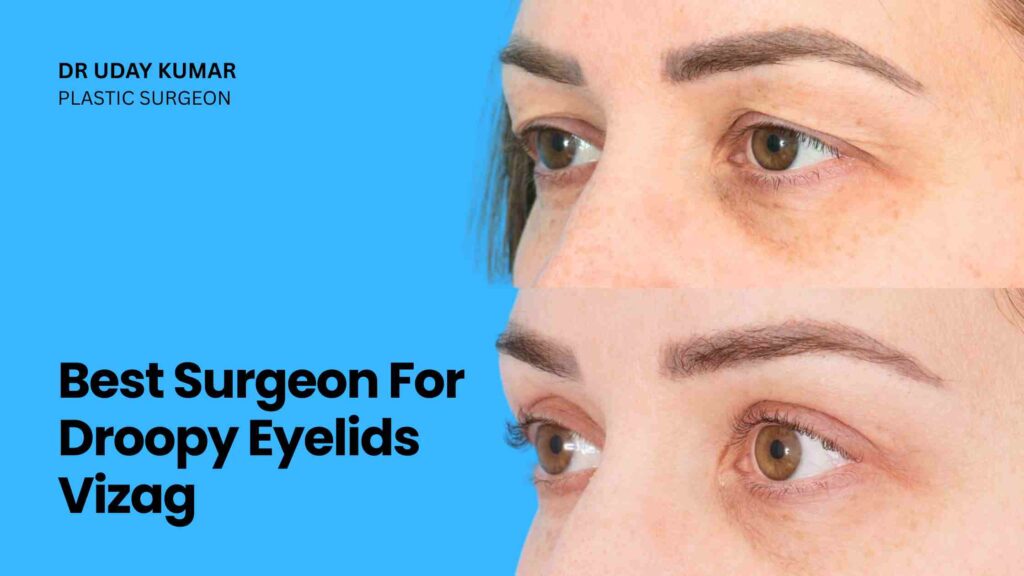 best surgeon for droopy eyelids Vizag