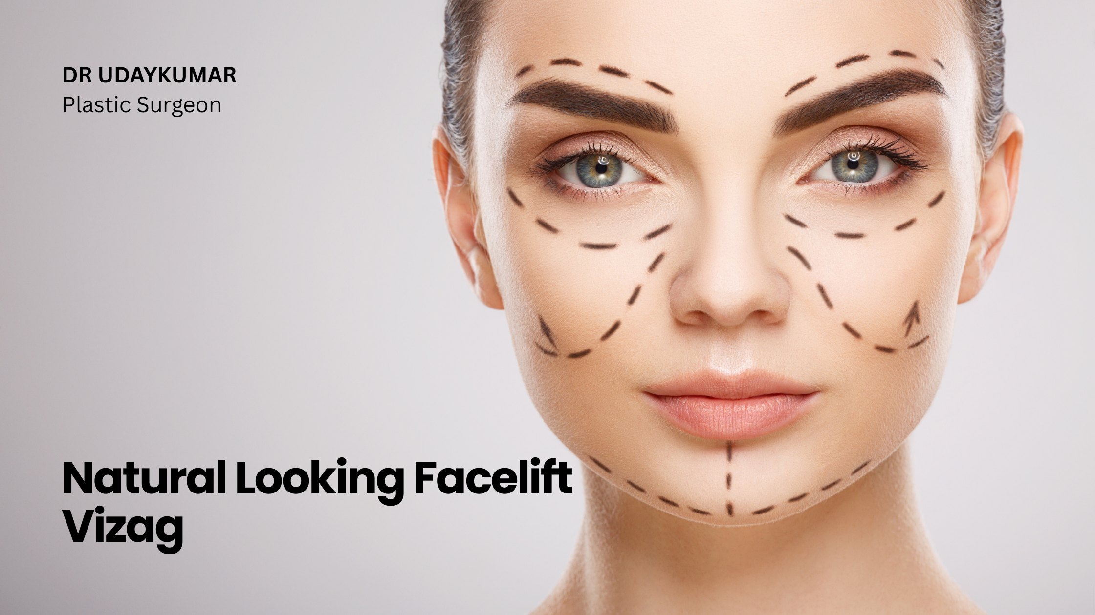 Natural Looking Facelift Vizag